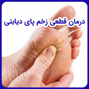 درمان قطعی زخم پای دیابتی